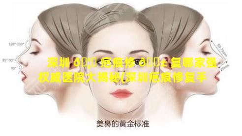 深圳 🦄 疤痕修 🐱 复哪家强权威医院大揭秘(深圳疤痕修复手术一般多少钱)